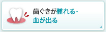 歯ぐきが腫れる・血が出る